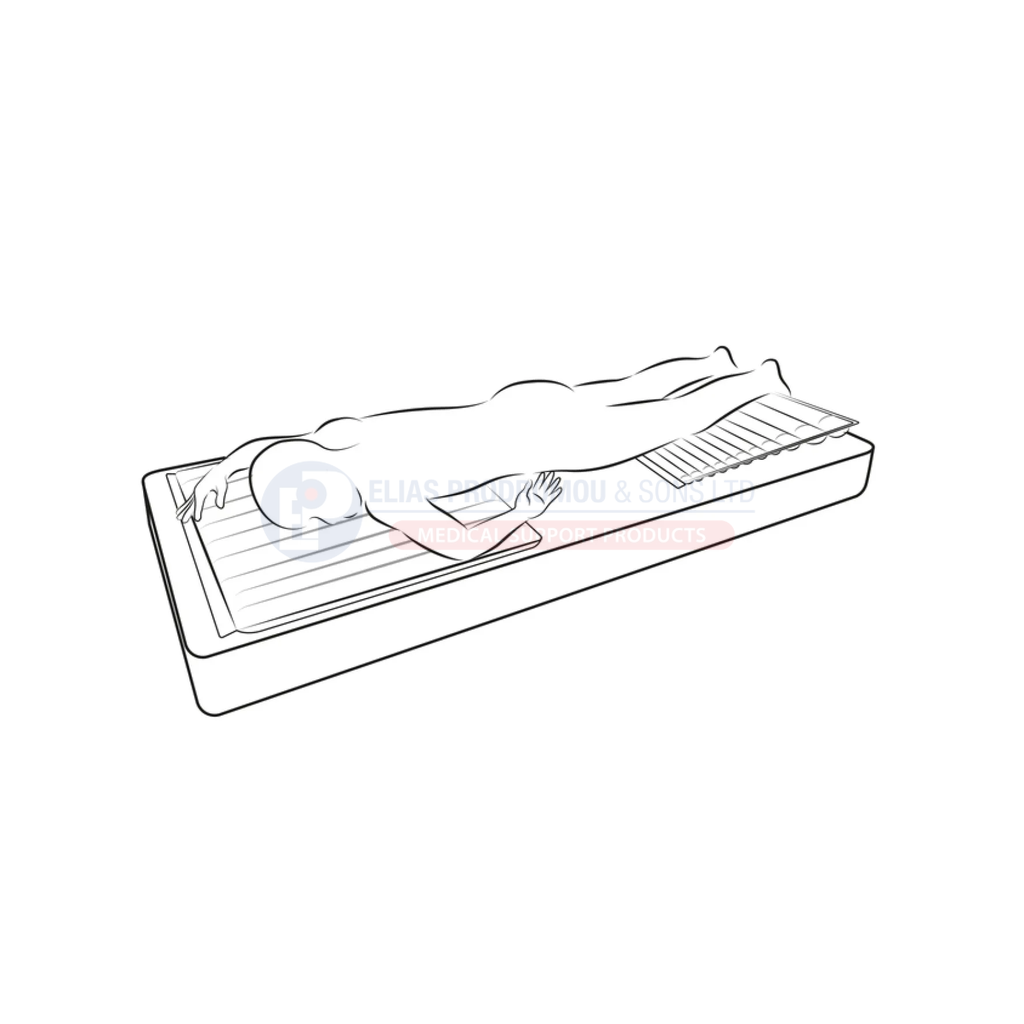 Supplier line illustration of a person in prone position on the overlay and wedge. Manufacturer illustration; trained clinical use with full IFU and local protocol.